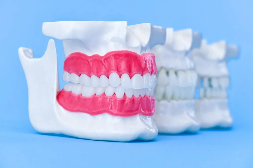 Retainers — our approach