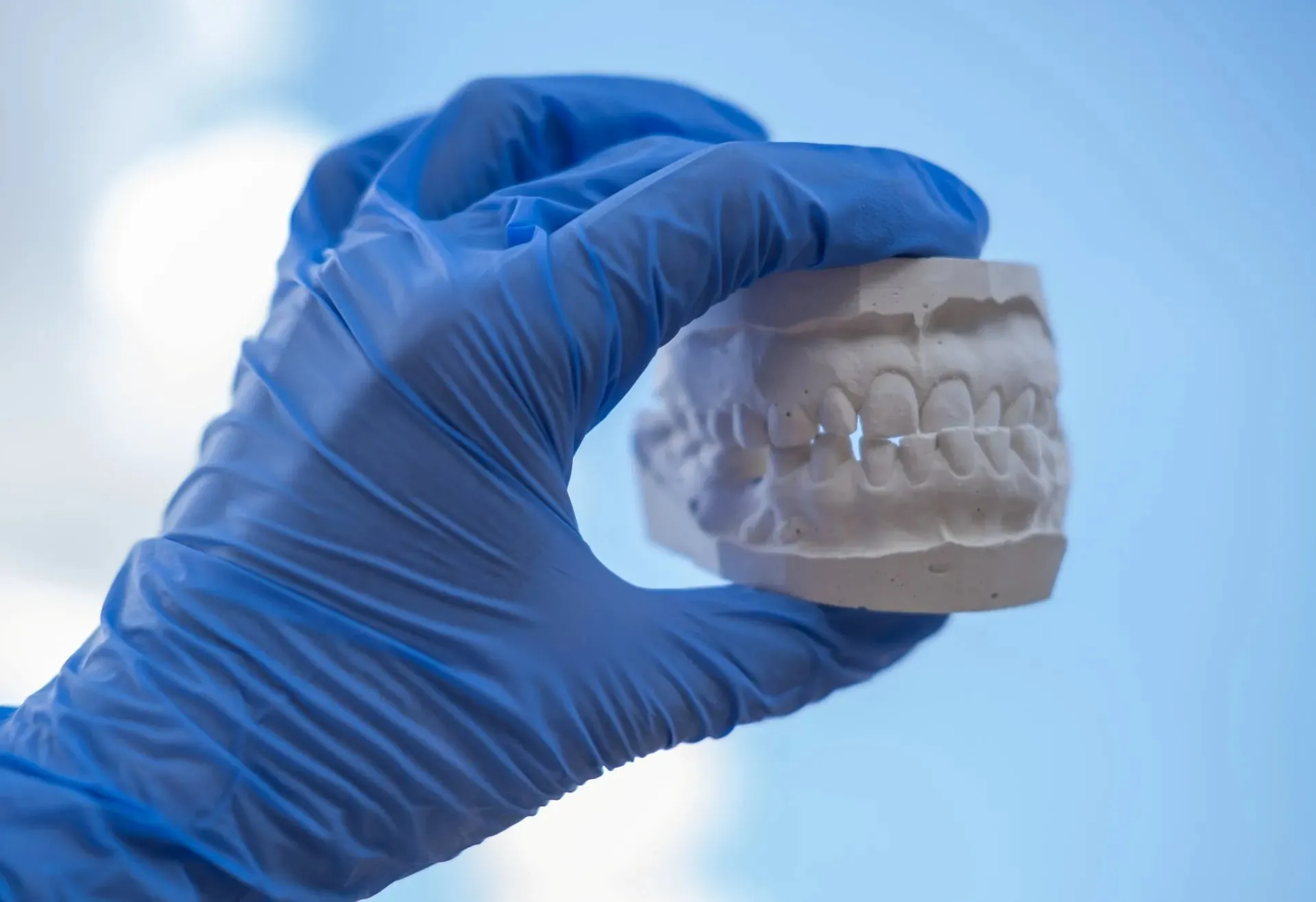 Dentures — our approach